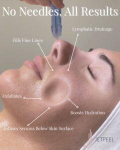 JetPeel facial at luxury Aveda salon in Houston, TX: exfoliates, hydrates, smooths fine lines, infuses serums for glowing skin. | Josephine's Salons and Spas | Houston, TX