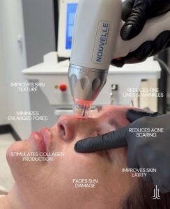 Client enjoys a luxury facial with a Nouvelle device at an Aveda Houston spa; benefits include refined skin texture, smaller pores, smoother wrinkles, and reduced sun damage. | Josephine's Salons and Spas | Houston, TX